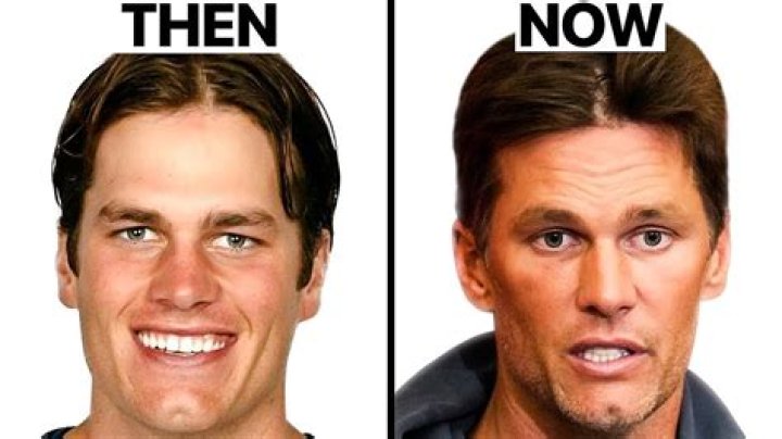 Tom Brady’s Before, After Photos Lead To Plastic Surgery Rumors